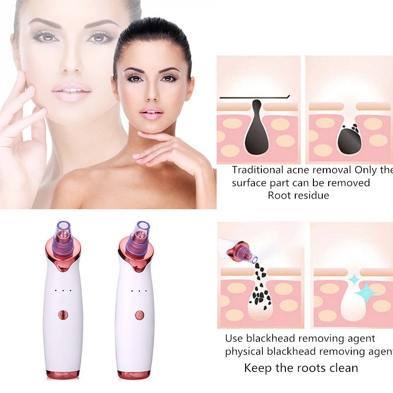 Blackhead remover for Beautiful Skin - Collumn