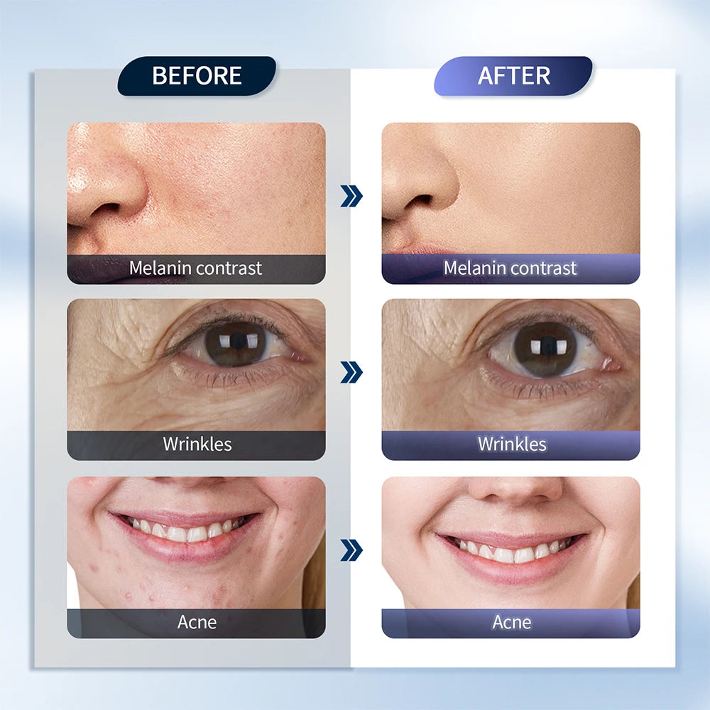 7-Color LED Light Therapy Face Mask with Nano Mist – Anti-Aging, Acne Treatment & Skin Rejuvenation Device - Collumn