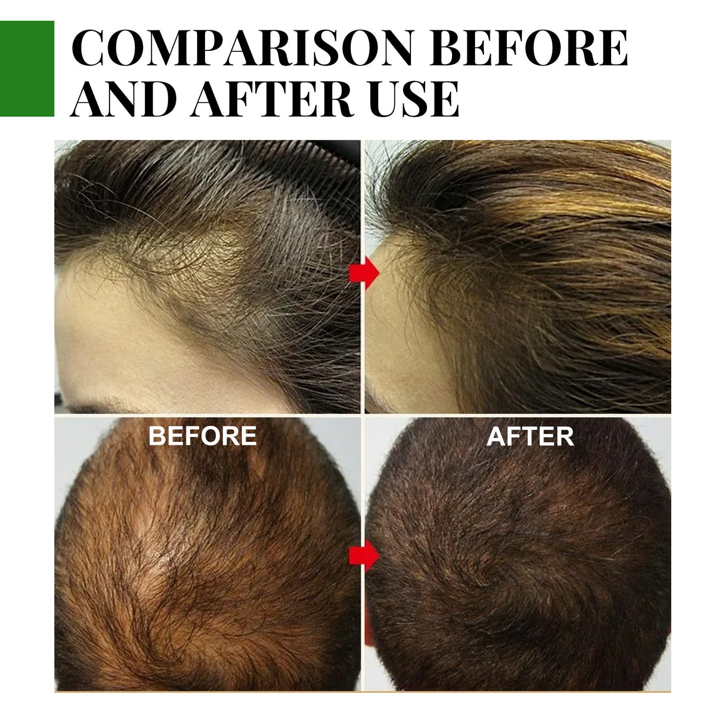 Beauty of NatureRosemary Hair Care Essential Oil - Collumn