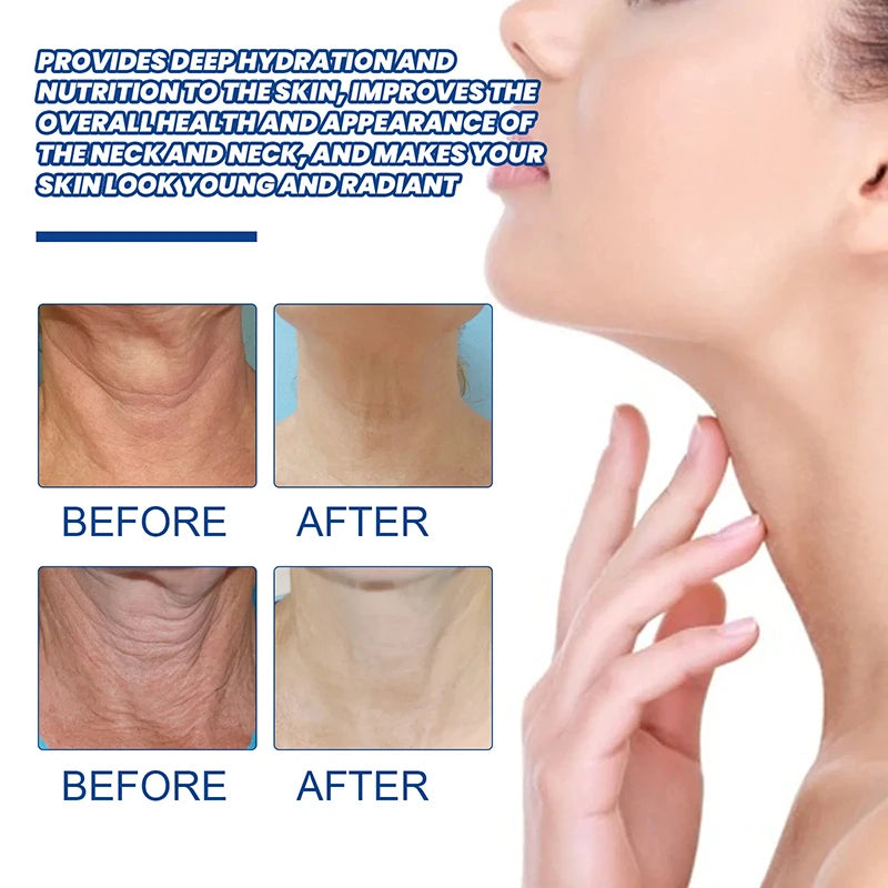 Incredible Neck Lines  CollagenProtein Cream - Collumn