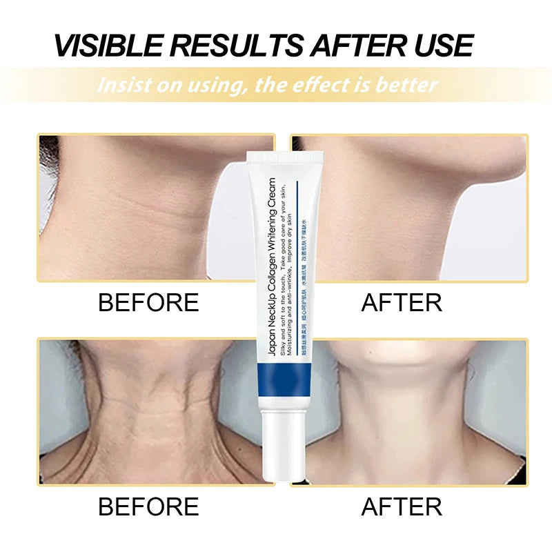 Incredible Neck Lines  CollagenProtein Cream - Collumn