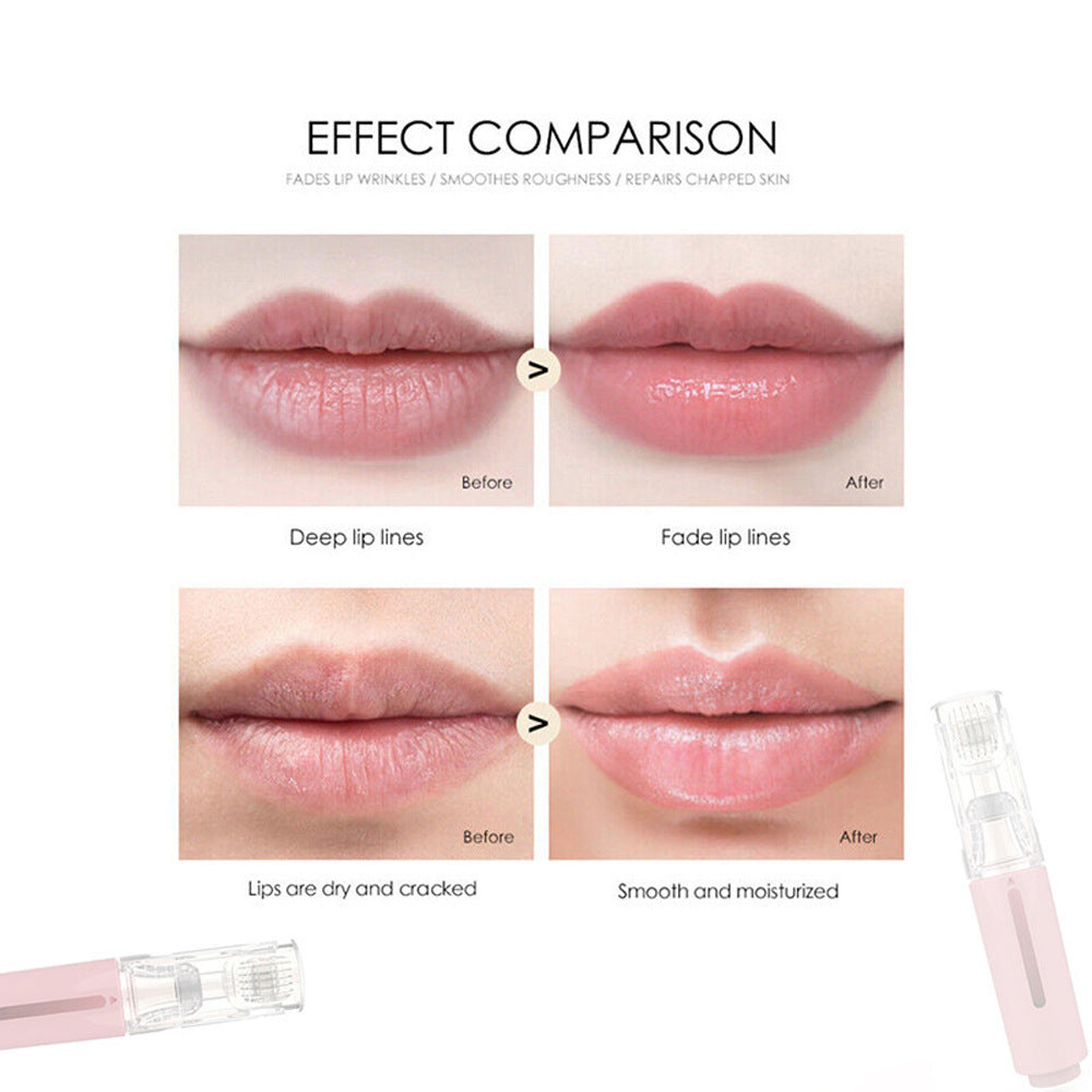 High Frequency Vibration Lip Massager - Collumn